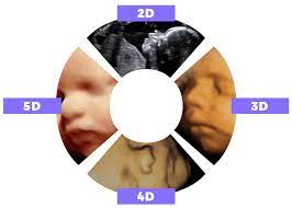 3D-4D-5D-SONOGRAPHY