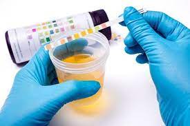 Urine Test