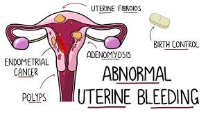 Uterine Bleeding